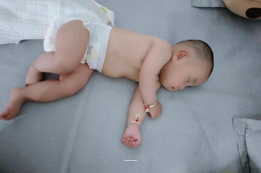 西宁六个月宝宝眼睛散光